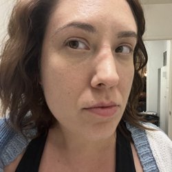 My nose that the dr said "did not show any injury"