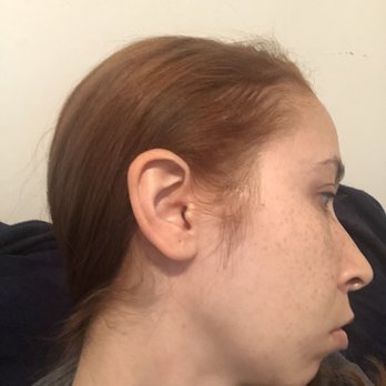 Made The Cut - Unfortunately I didn't notice in the shop the spots missing dye:( - Hair Salons Near Me - Brooklyn, New York Made The Cut - Unfortunately I didn't notice in the shop the spots missing dye:( - Hair Salons Near Me - Brooklyn, New York