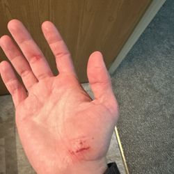 Waldo's Campus Tavern - The result of my psychical assault and removal