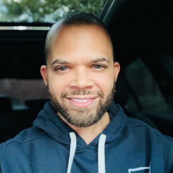 Reddy Aesthetic Institute - Post op, about 8 months and freshly Botoxed! - Plastic Surgeons Near Me - Atlanta, Georgia Reddy Aesthetic Institute - Post op, about 8 months and freshly Botoxed! - Plastic Surgeons Near Me - Atlanta, Georgia