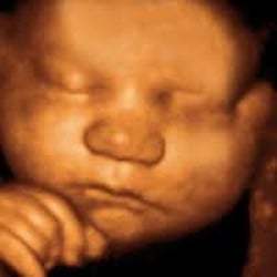 Perinatal Diagnostic Center & Women's Ultrasound - Love my pictures