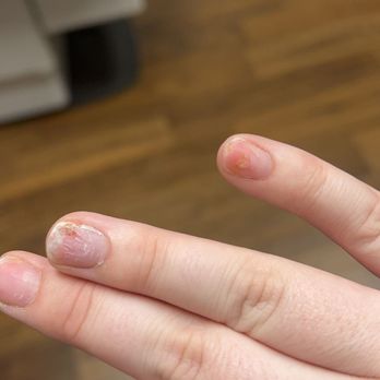 Envy Nails and Spa - This is what my nails be looking like, my ring busted and my pinky is infected - Waxing Near Me - Sioux Falls, South Dakota Envy Nails and Spa - This is what my nails be looking like, my ring busted and my pinky is infected - Waxing Near Me - Sioux Falls, South Dakota