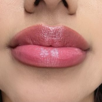 Beverly Hills Rejuvenation Center - Center CityCentre - Houstons best Lip filler - Medical Spas Near Me - Houston, Texas Beverly Hills Rejuvenation Center - Center CityCentre - Houstons best Lip filler - Medical Spas Near Me - Houston, Texas
