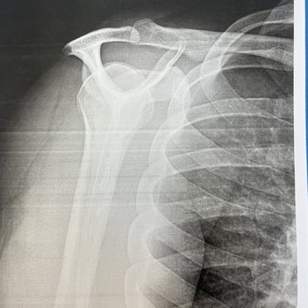 Platinum Orthopaedics - I was referred to Dean Wang and he confirmed medical malpractice by blanks - Orthopedists Near Me - Anaheim, California