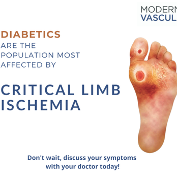Modern Vascular - Glendale - Vascular Medicine Near Me - Glendale, Arizona Modern Vascular - Glendale - Vascular Medicine Near Me - Glendale, Arizona