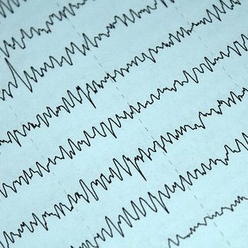 Tucson Neurofeedback - The ability to read raw EEG data allows our clinicians to pick up on patterns that might otherwise be missed. - Counseling & Mental Health Near Me - Tucson, Arizona
