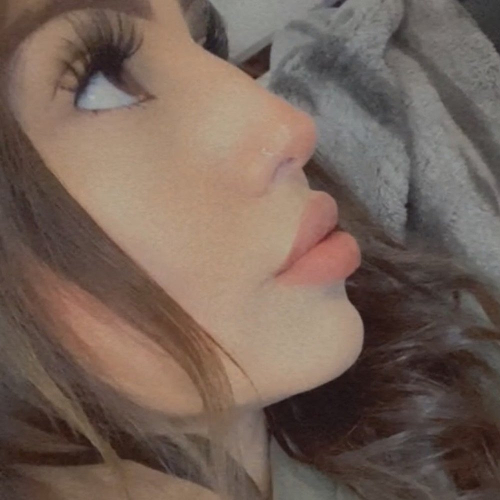 Lazer Lounge - Non Surgical Rhinoplasty + Lip Filler - Laser Hair Removal Near Me - Studio City, California Lazer Lounge - Non Surgical Rhinoplasty + Lip Filler - Laser Hair Removal Near Me - Studio City, California