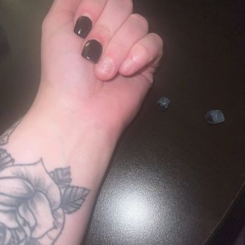 New Star spa&nails - Left hand that lost nails. Right hand lost index finger and middle finger. - Nail Salons Near Me - Canastota, New York New Star spa&nails - Left hand that lost nails. Right hand lost index finger and middle finger. - Nail Salons Near Me - Canastota, New York