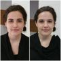 Photo of Chicago Permanent Makeup by Lana Schluter RN, BSN