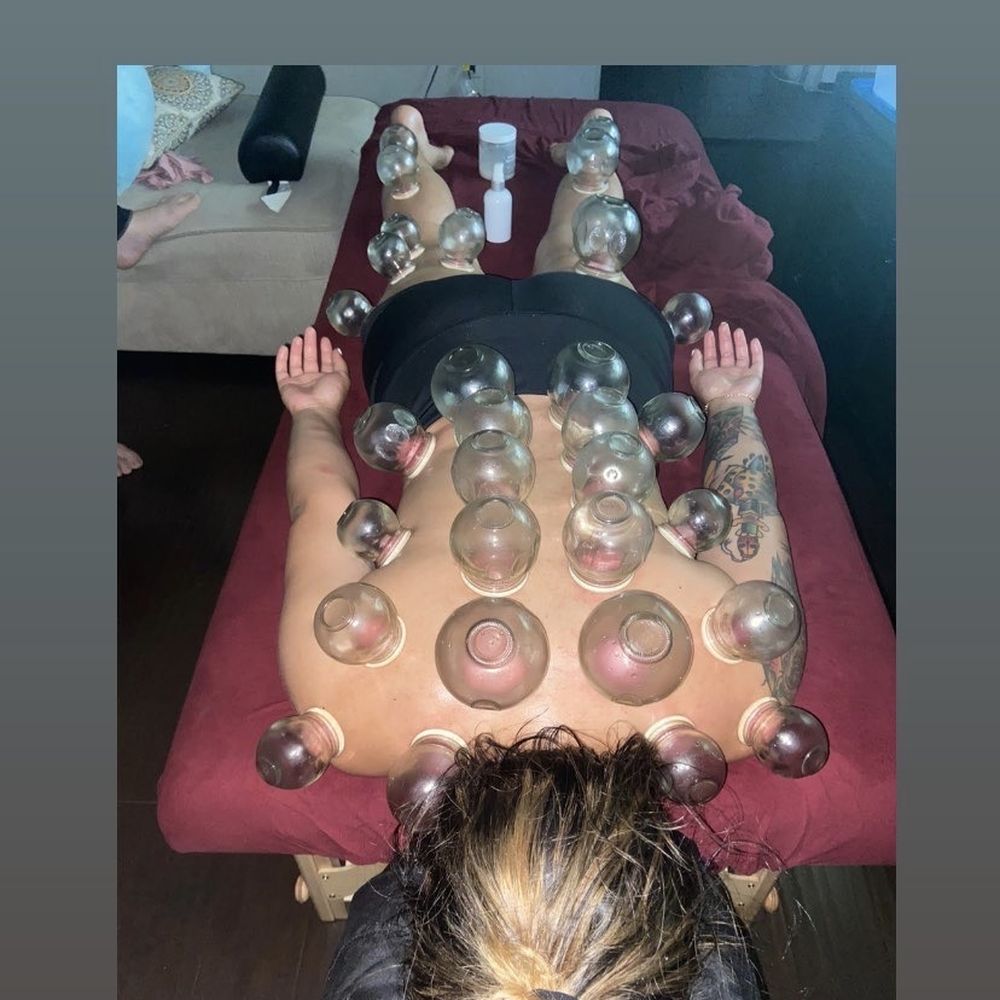 Amazing cupping becomes a addiction Amazing cupping becomes a addiction