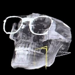 xray
