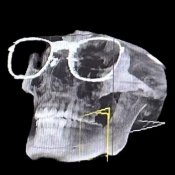 In Line Dentistry - xray - General Dentistry Near Me - Diamond Bar, California