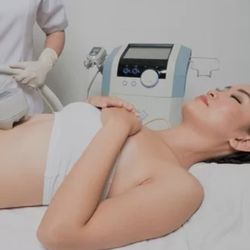 Le Shape - Exilis Ultra Fat Melting on Stomach