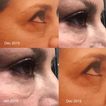 Thomas L Tzikas, MD - Cosmetic Surgeons Near Me - Delray Beach, Florida