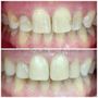 Photo of Valentina Babuchyan, DDS - Valley Dental Spa