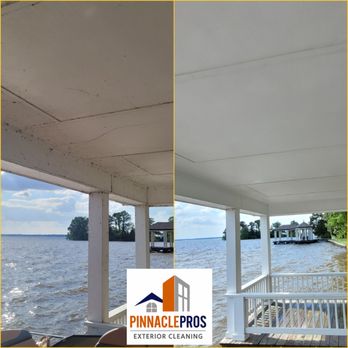 Pinnacle Pros Exterior Cleaning - (Before/After) Soft wash cleaning boat house in Madison Mississippi. - Pressure Washers Near Me - Brandon, Mississippi Pinnacle Pros Exterior Cleaning - (Before/After) Soft wash cleaning boat house in Madison Mississippi. - Pressure Washers Near Me - Brandon, Mississippi