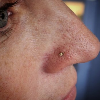 Erin's Aesthetics - Gold Marquise by Ember - Piercing Near Me - Centerton, Arkansas