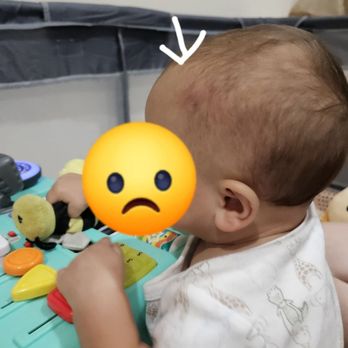 LA Fitness - Red and purple mark on our baby's head - Gyms Near Me - Wellington, Florida LA Fitness - Red and purple mark on our baby's head - Gyms Near Me - Wellington, Florida