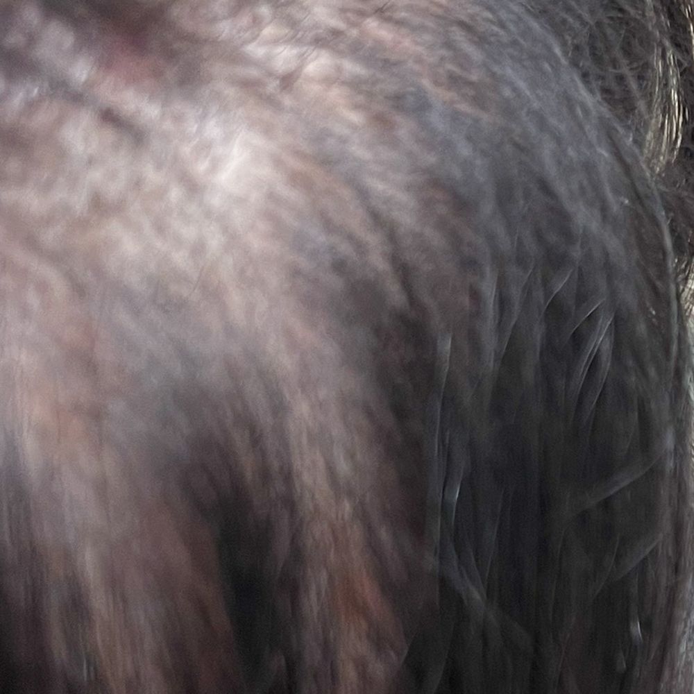Empire Beauty School - Extremely painful scalp where extensions were ripped out. - Cosmetology Schools Near Me - York, Pennsylvania Empire Beauty School - Extremely painful scalp where extensions were ripped out. - Cosmetology Schools Near Me - York, Pennsylvania