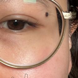 Chelsea Skin and Laser