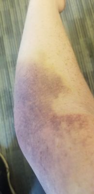 BioLife Plasma Services