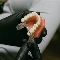 Vida Dental Buda - Invisalign clear aligners