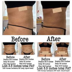 Body Sculpting Chula Vista & Spa