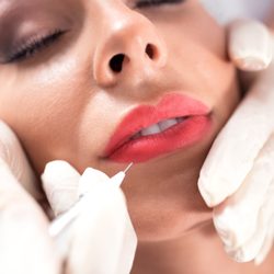 Steven Silverman - Lip Fillers to create very SMOOCH-able Lips.