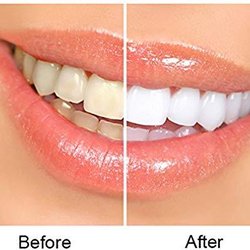 Best Dental