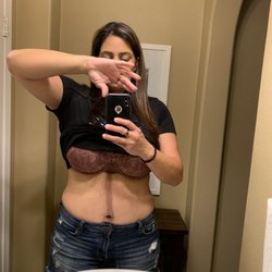Festus B Dada, MD JD - This is my stomach today. Ruined!!!! All because Dr Dada was 3 hours late to my appointment because he wanted to hurry!!!