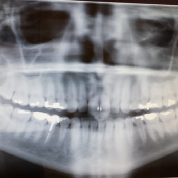 David Cedeno, DDS, MD - Oral Surgeons Near Me - Los Angeles, California