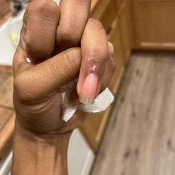 Star Nail Spa - After the bleeding finally stopped I have a huge chunk of skin missing! Never coming to this place again - Nail Salons Near Me - Vacaville, California Star Nail Spa - After the bleeding finally stopped I have a huge chunk of skin missing! Never coming to this place again - Nail Salons Near Me - Vacaville, California