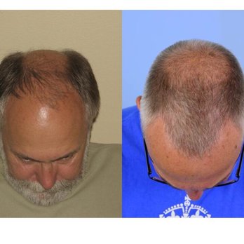 Shapiro Medical Group - Cosmetic Surgeons Near Me - Minneapolis, Minnesota Shapiro Medical Group - Cosmetic Surgeons Near Me - Minneapolis, Minnesota