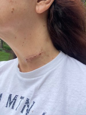 Angela M Santini, MD