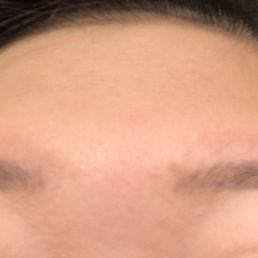 1 year later