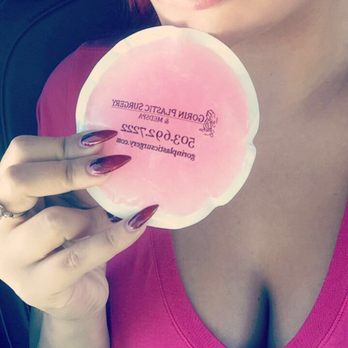 Gorin Plastic Surgery & Medspa - Right after my lip treatment! Stunningly perfect even immediately when done :) - Cosmetic Surgeons Near Me - Tualatin, Oregon