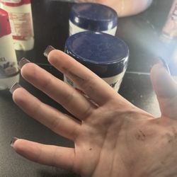 Hawaii Nails - This is how my hand was left, i cannot make this up.