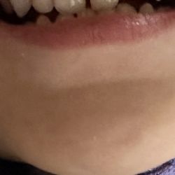 Children's Dentistry of Inland Empire
