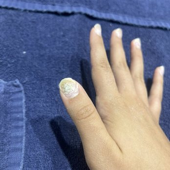Venice Nails and Spa - mold - Waxing Near Me - Broken Arrow, Oklahoma Venice Nails and Spa - mold - Waxing Near Me - Broken Arrow, Oklahoma