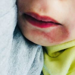 Great Expressions Dental Centers - Linebaugh