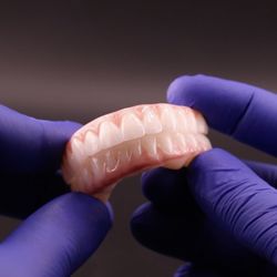 Mesa Dental Implants and Dentures