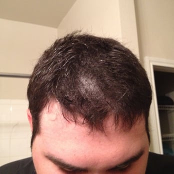 Salon Rizos - My boyfriends haircut... The worst I've ever seen!!! - Waxing Near Me - Frisco, Texas Salon Rizos - My boyfriends haircut... The worst I've ever seen!!! - Waxing Near Me - Frisco, Texas