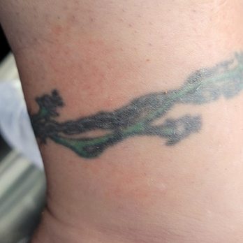 Fallen Angel Tattoos - Before 1 - Tattoo Near Me - West Jordan, Utah