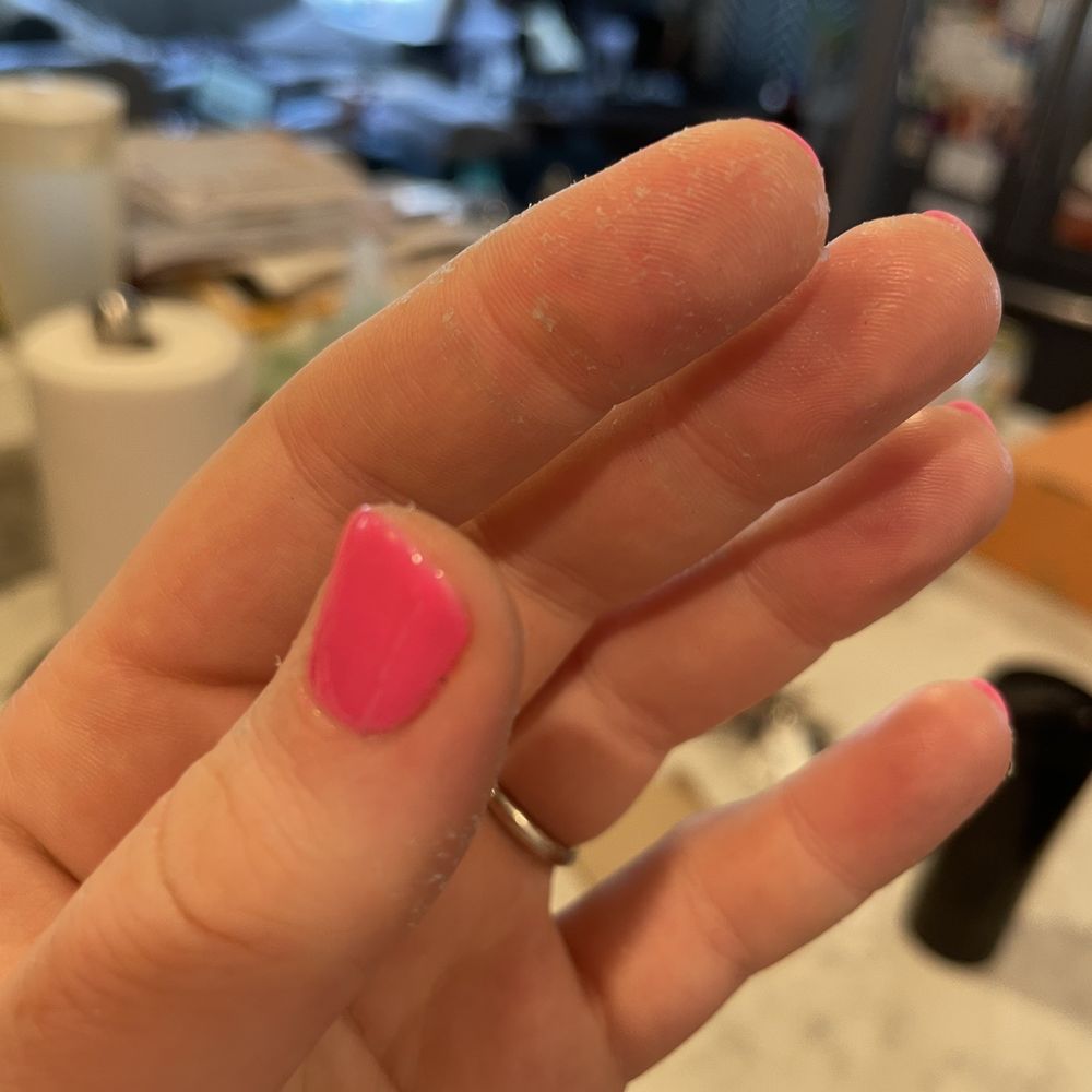 Luxury Nail Spa - Chemical burn - Waxing Near Me - Decatur, Georgia Luxury Nail Spa - Chemical burn - Waxing Near Me - Decatur, Georgia