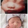 3D-4D Ultrasound Studio Queens