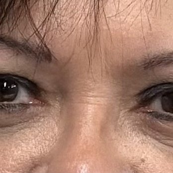 Ivan Vrcek, MD - AFTER - Cosmetic Surgeons Near Me - Dallas, Texas Ivan Vrcek, MD - AFTER - Cosmetic Surgeons Near Me - Dallas, Texas