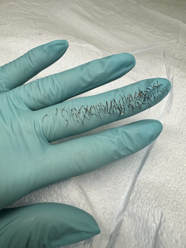 BLUSH ELECTROLYSIS & SKIN CARE with photos Updated August 2024 109