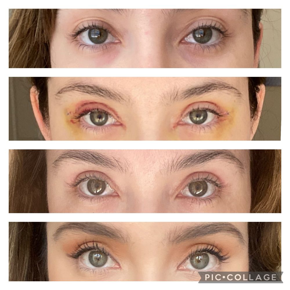 San Diego Eyelid Specialists Logo