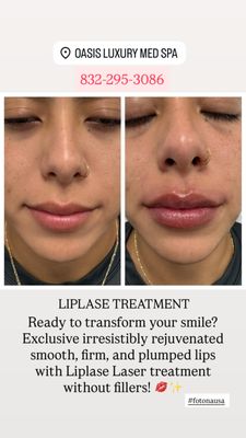 Oasis Luxury Med Spa