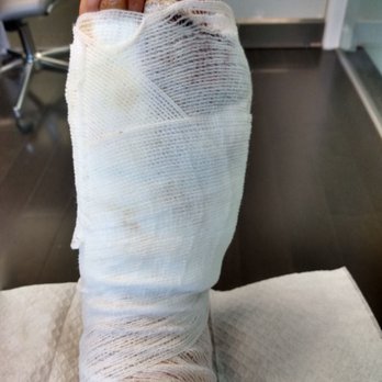 Henry Tseng, DPM - The new wrapping job over my surgery area. - Podiatrists Near Me - West Covina, California Henry Tseng, DPM - The new wrapping job over my surgery area. - Podiatrists Near Me - West Covina, California